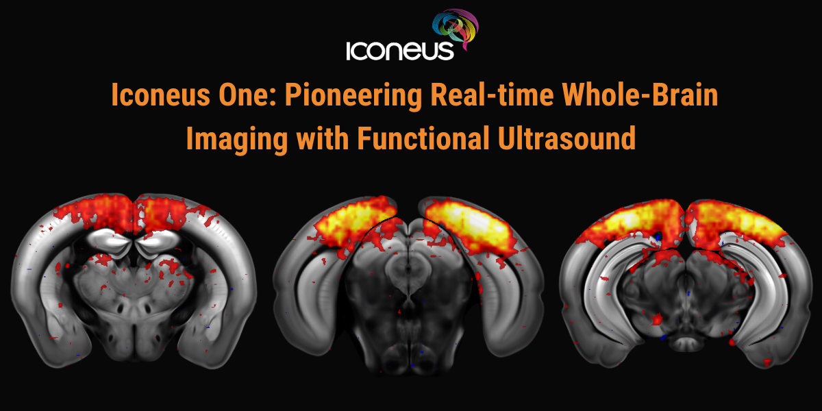 Pioneering Real-time Whole-Brain Imaging with Functional Ultrasound
