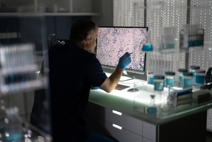 Carboplatin Omission Appears Safe in Select Patients With HER2+ Breast Cancer