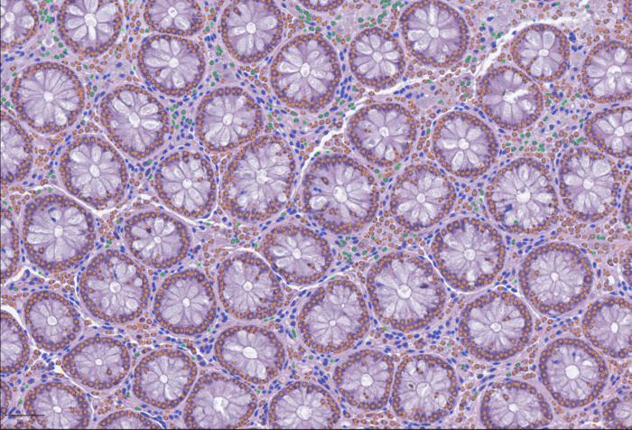 Open Framework for Integrating Whole-Slide and Molecular Data