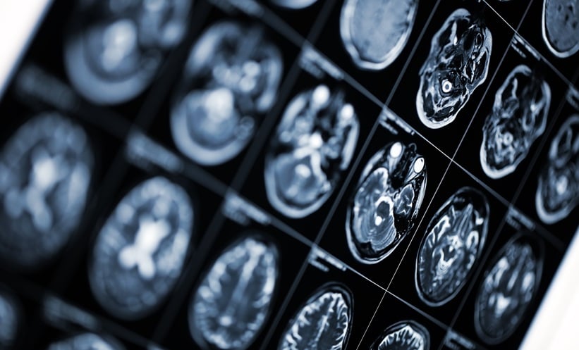 GLP-1RAs Could Help Type 2 Diabetes and Brain Cancer