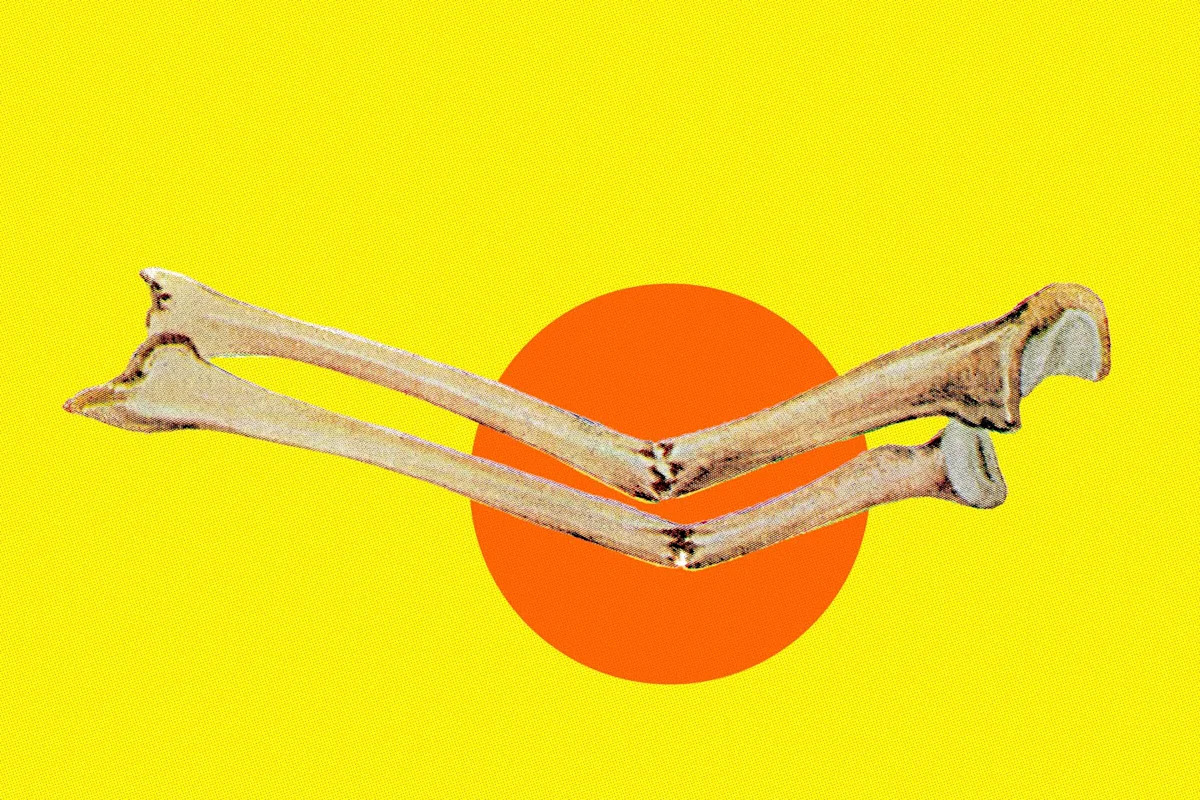 Atmospheric CO2 Getting So High That It’s Weakening Human Skeletons