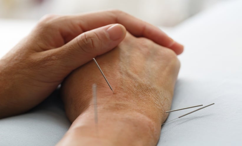 Manual Acupuncture Reduces Rheumatoid Arthritis Pain