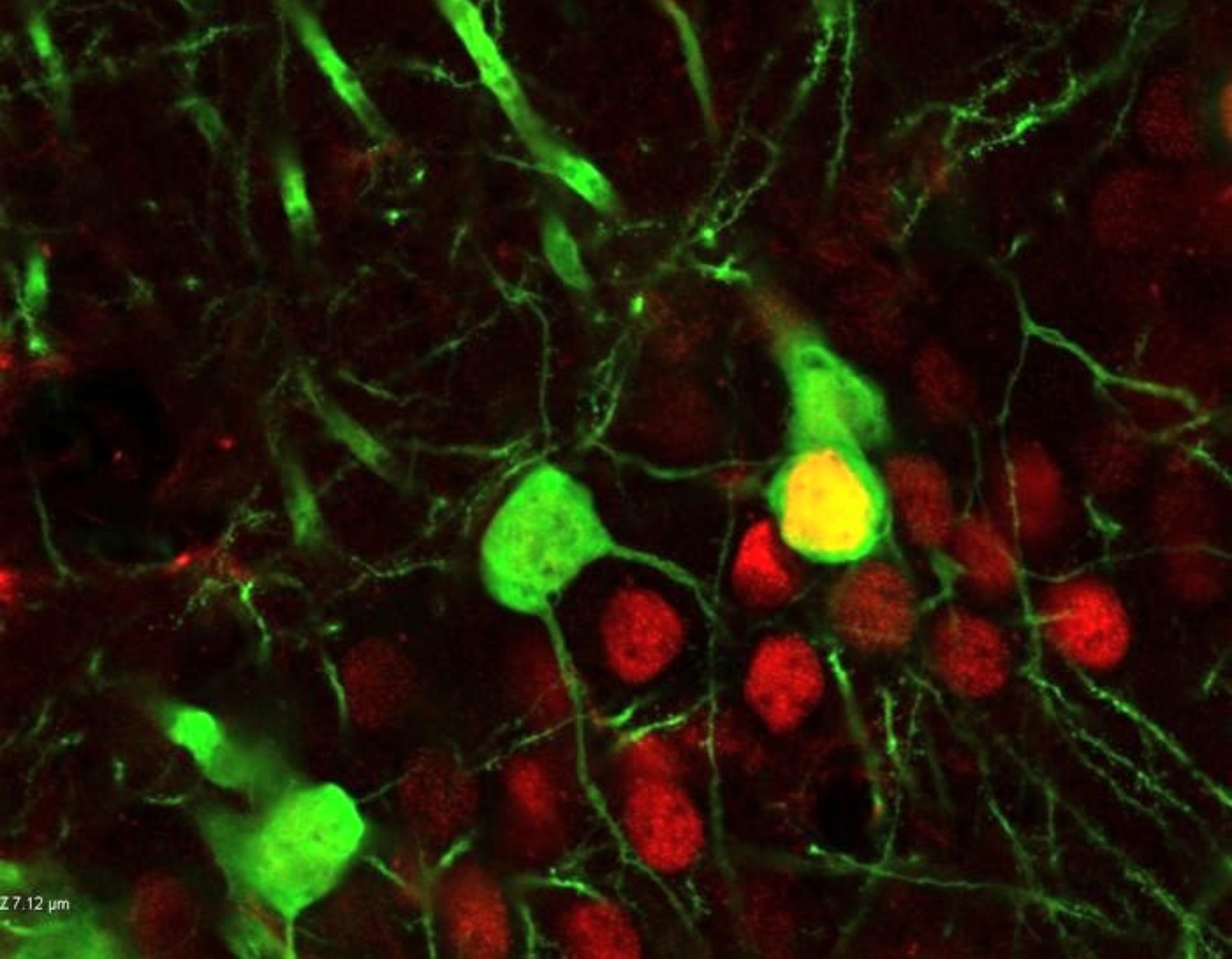 Cocaine rewires brain circuits in ways that can trigger relapse