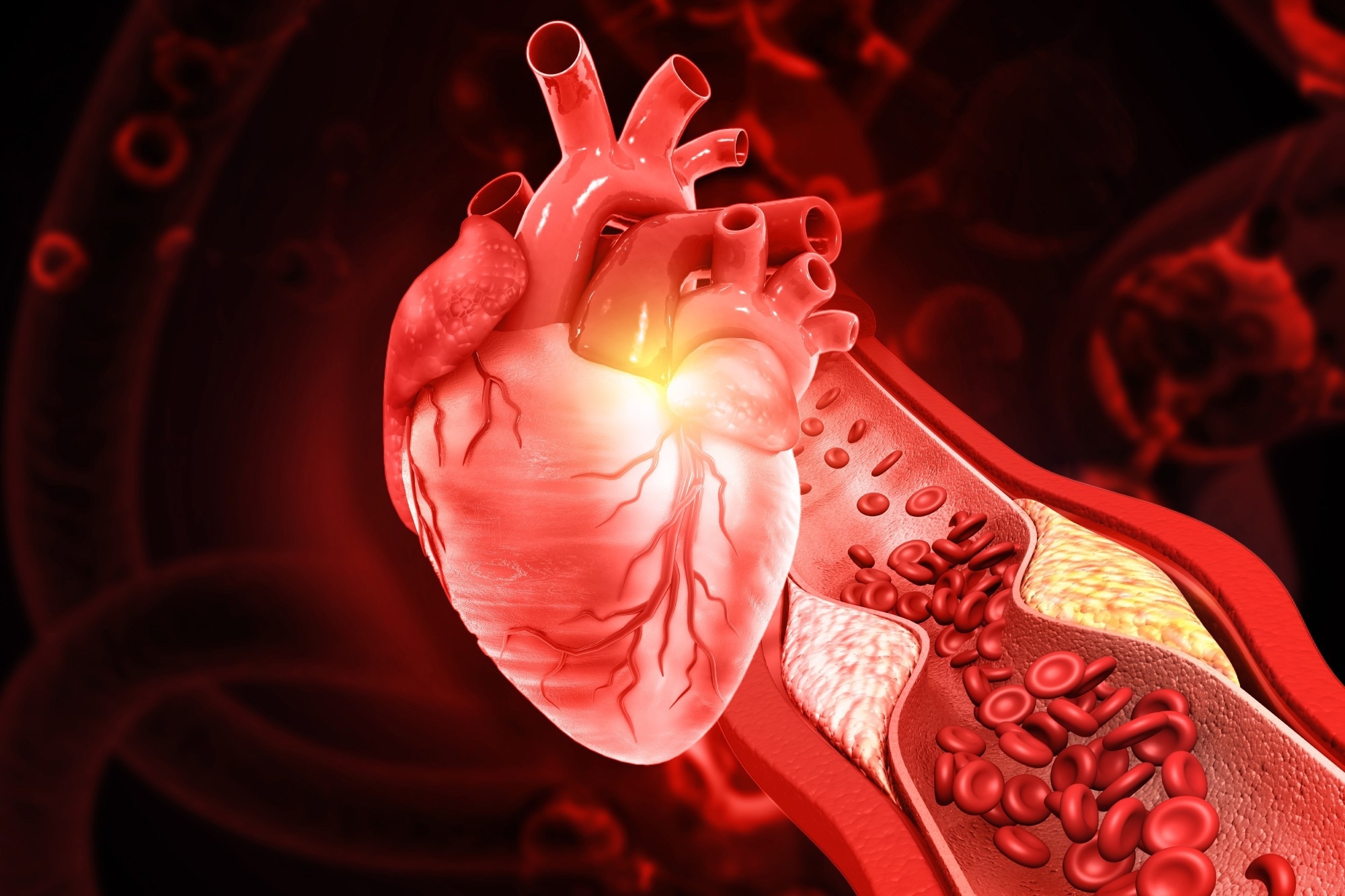 Gut-derived blood markers may help predict who develops coronary heart disease