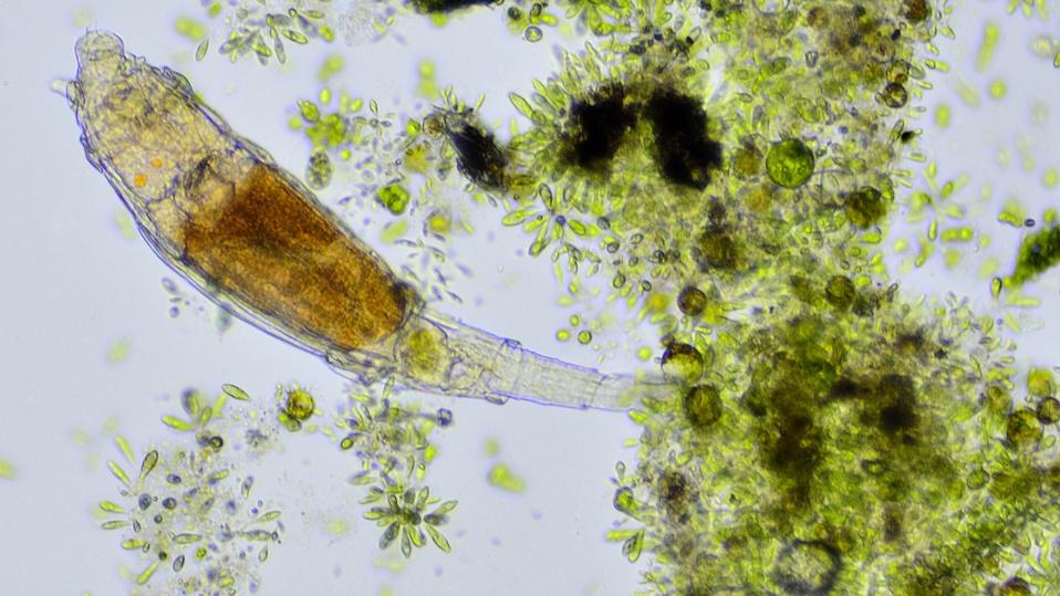 Meet Bdelloid Rotifers — The Organism That Survives 1,000 Times The Radiation That Kills Humans