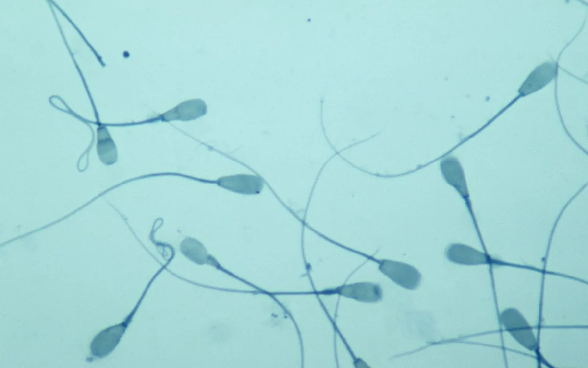 Sperm sent on obstacle course to test limits of space colonisation