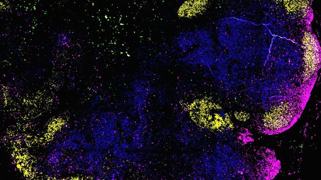Lymph Node Mapping Reveals Lymphoma Mechanism