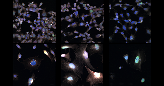 Signs of aging vary across brain cells