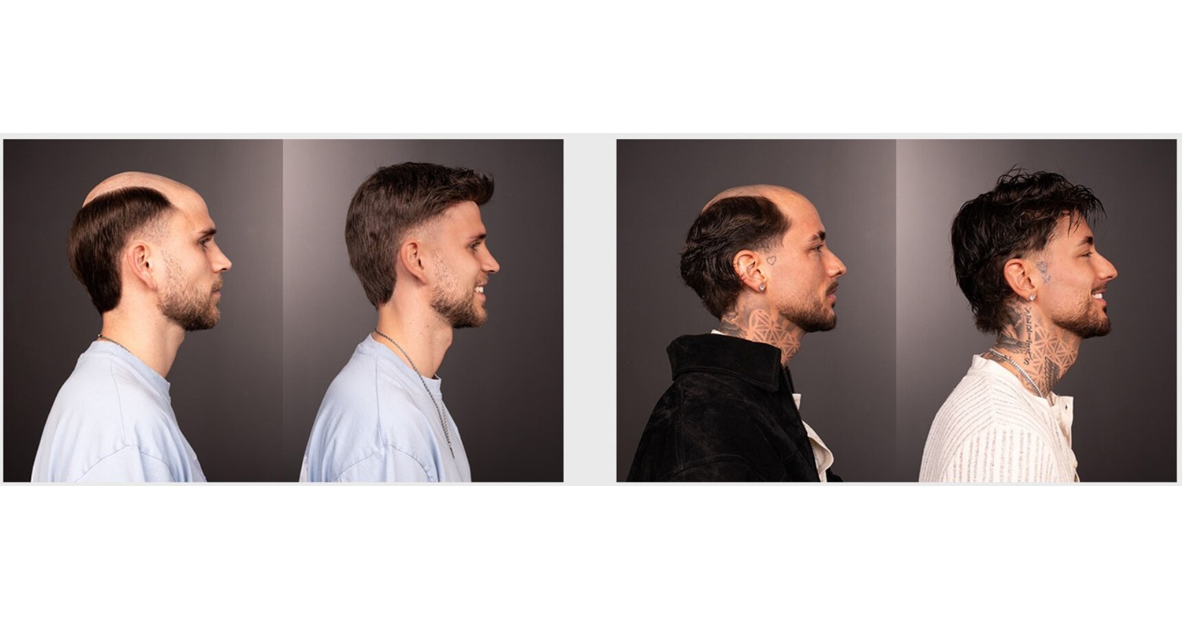 LaVivid Launches Its First Hair Solution Studio in Munich