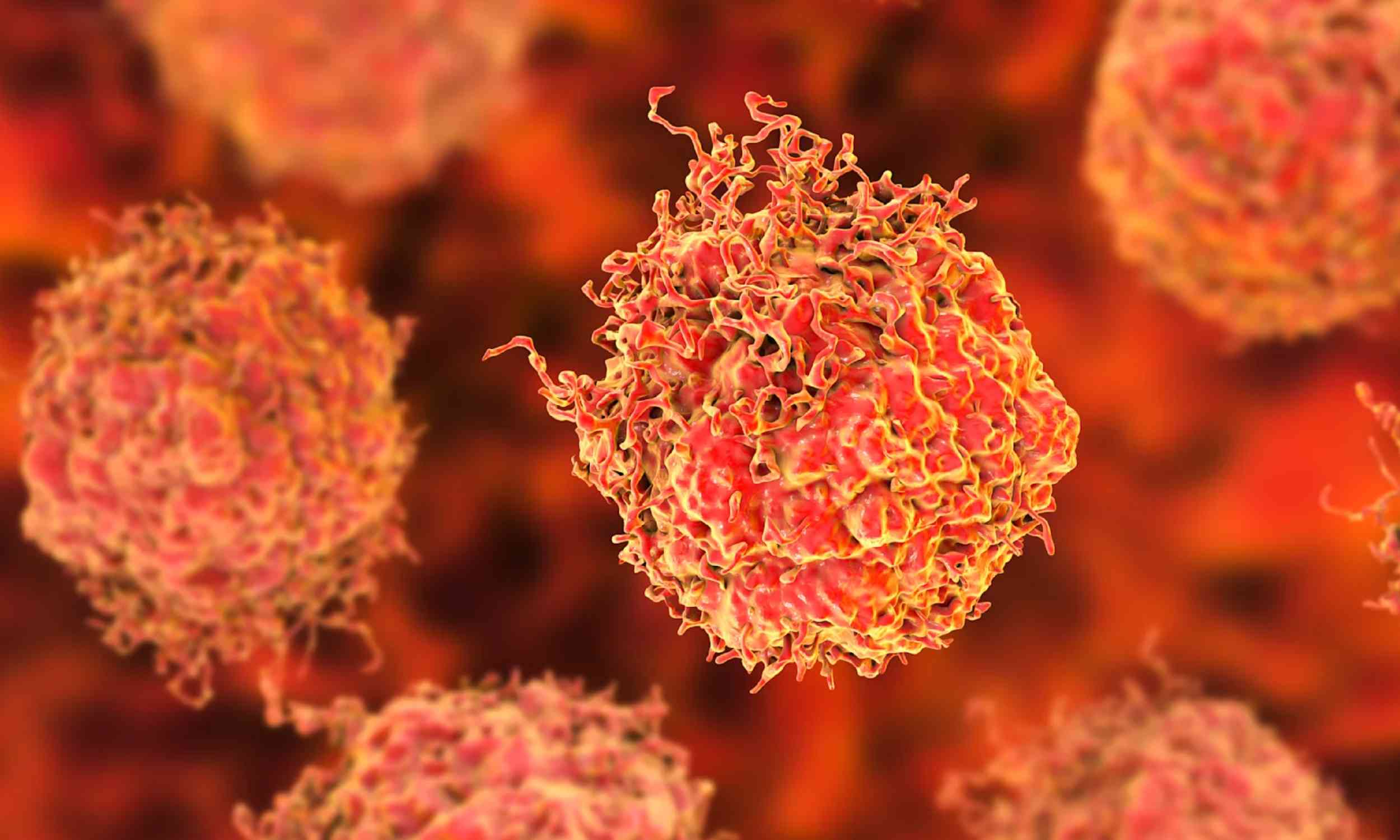 Low testosterone may signal high-risk prostate cancer