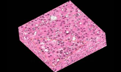 New X-ray technique could transform tissue diagnosis • healthcare-in-europe.com