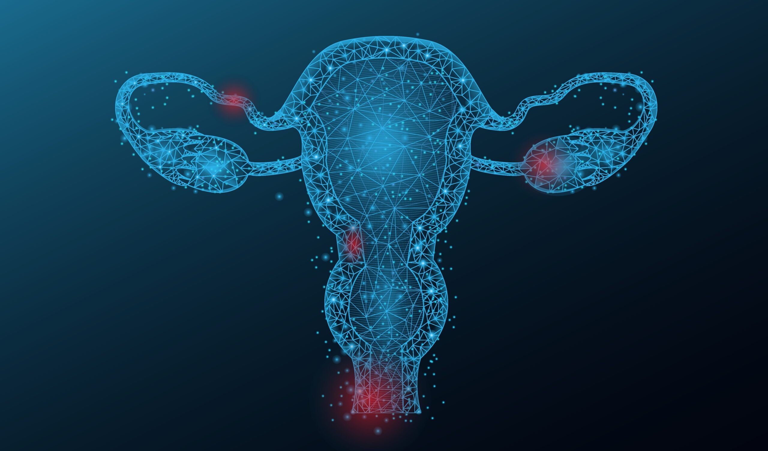 Blocking FAK protein may help to overcome resistance in ovarian cancer