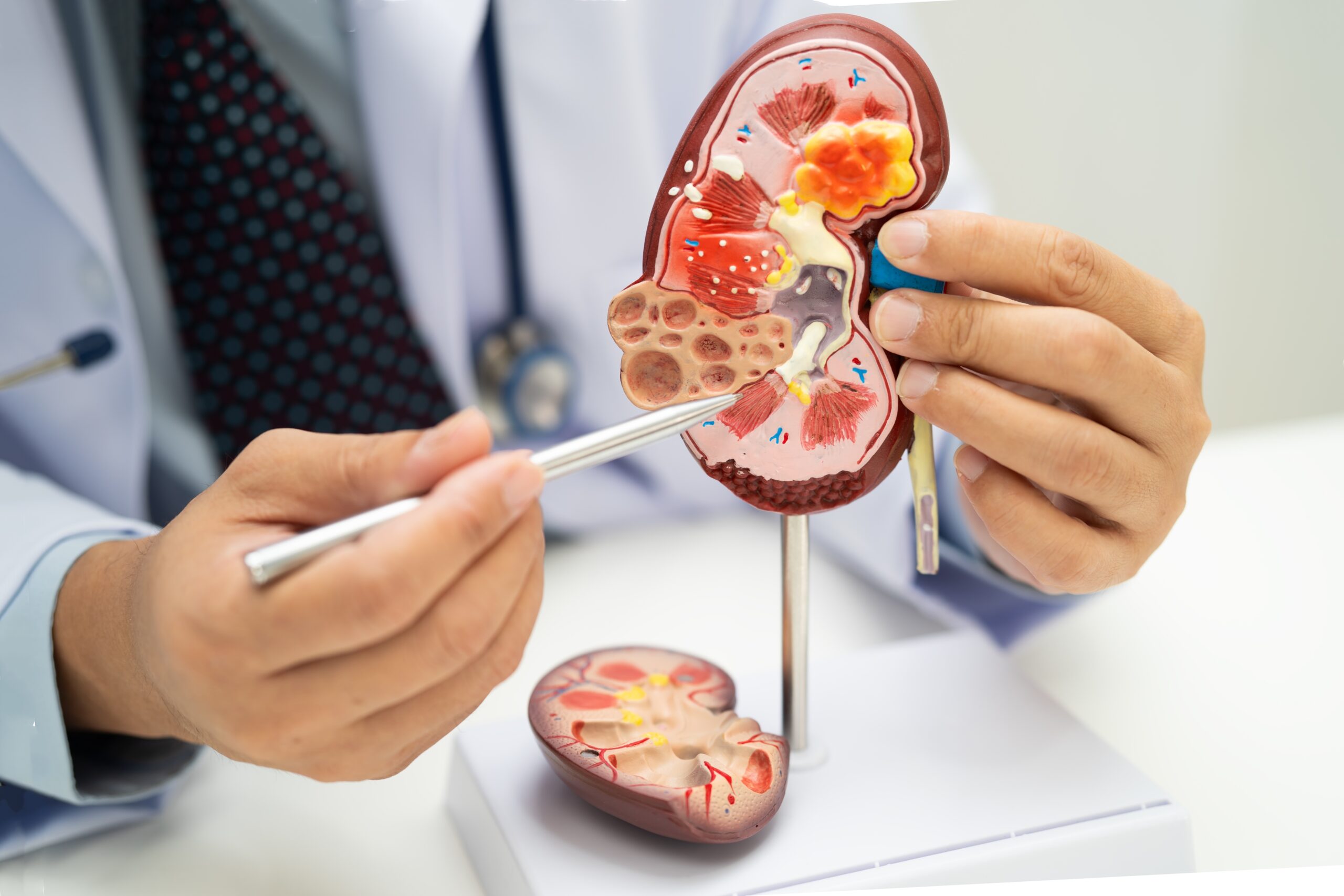 Gut microbes found to drive chronic kidney disease