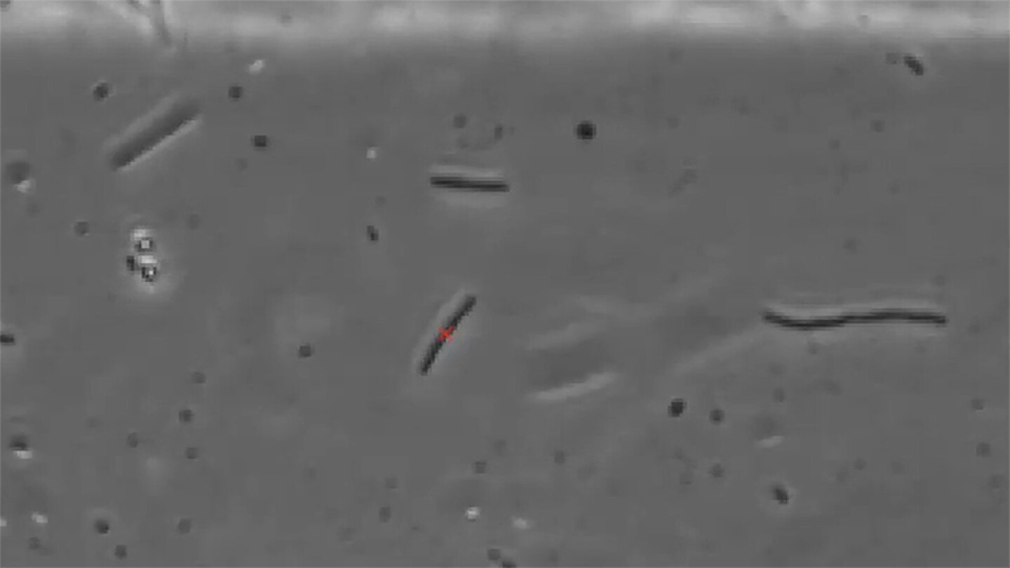 The wiggling of E. coli: Preventing infection through an investigation of swimming dynamics