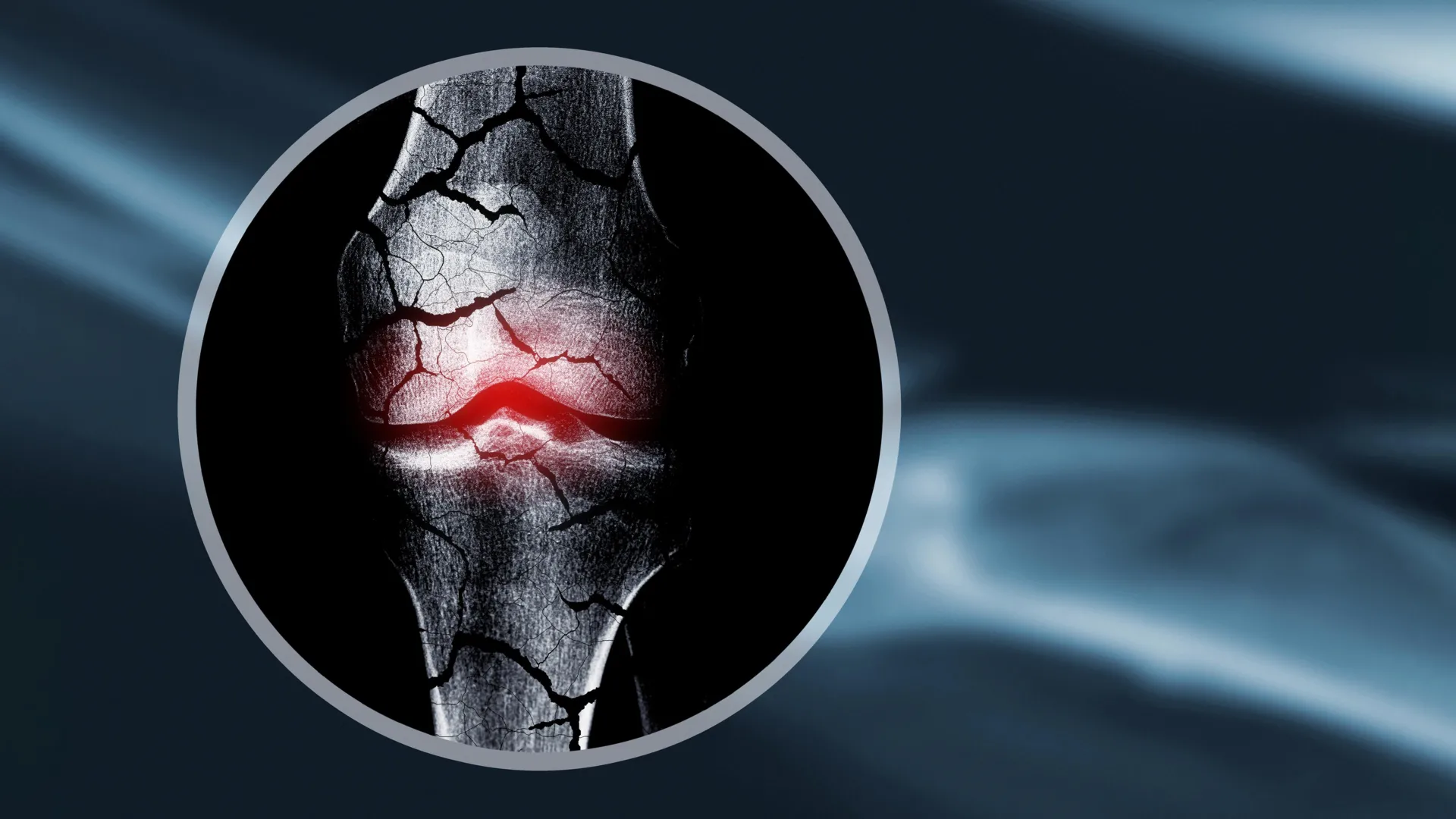 These “forever chemicals” could be weakening kids’ bones for life