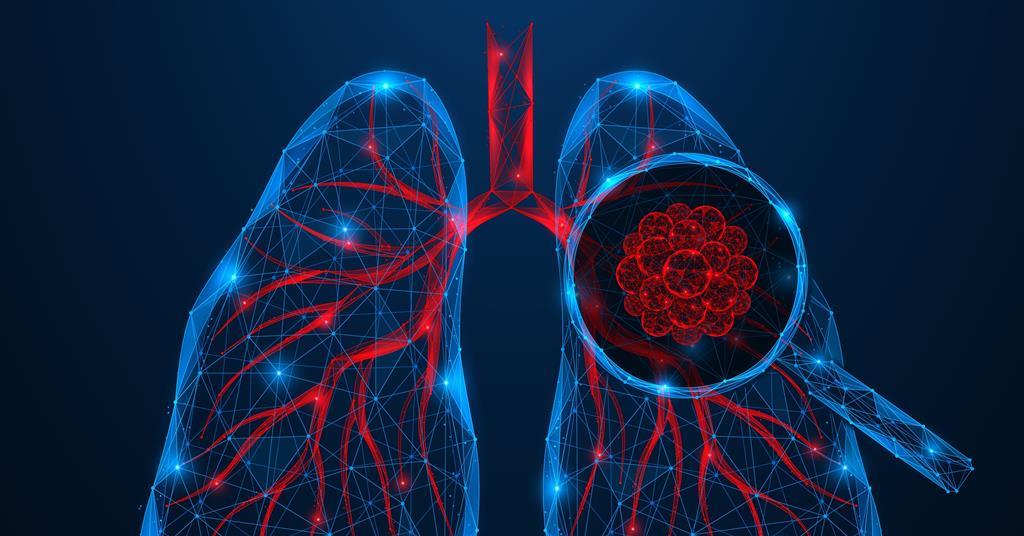 Immune mapping technique reveals lung cancer microenvironment at single-cell resolution