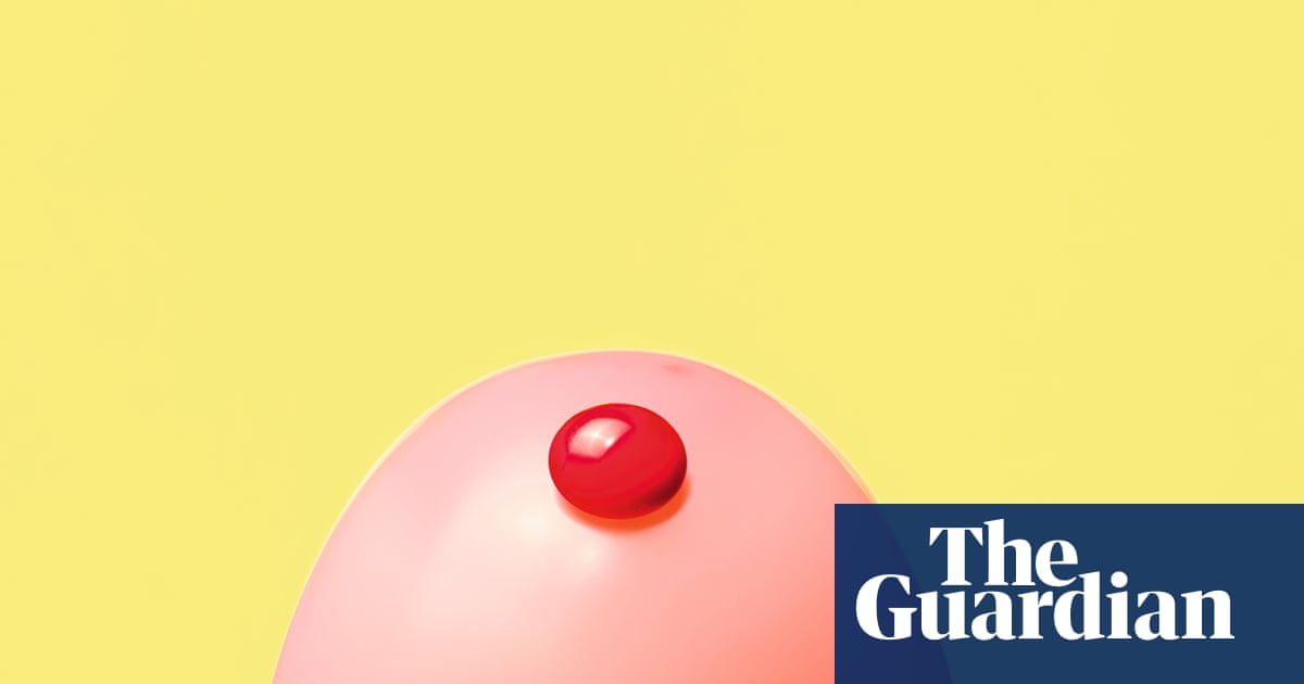 ‘They’re all junk, and should be banned’: the trouble with at-home food intolerance tests | Health & wellbeing