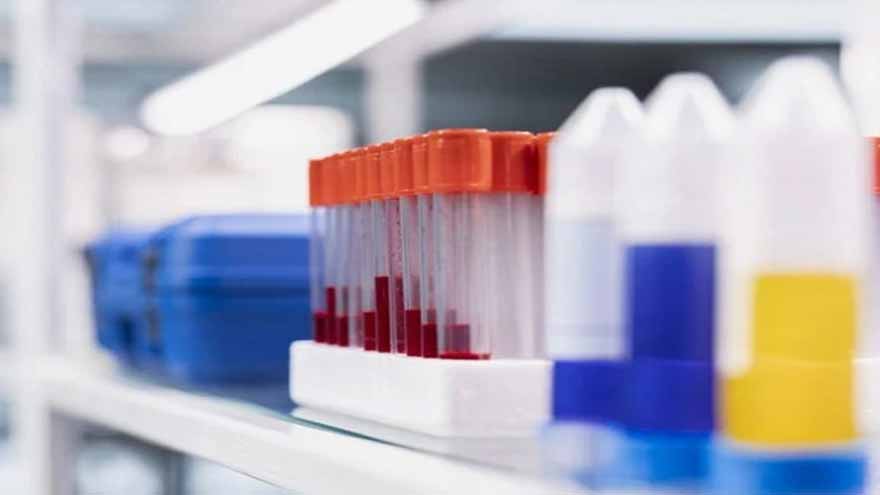 Scientists develop new technology to detect active, infectious Tuberculosis