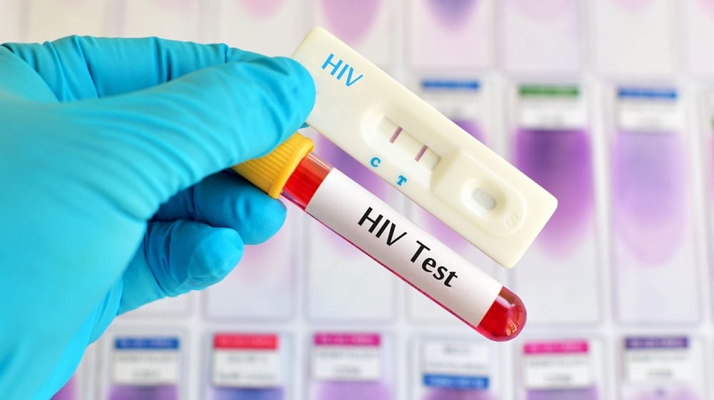 Health Ministry Rejects HIV Outbreak Claims in Islamabad