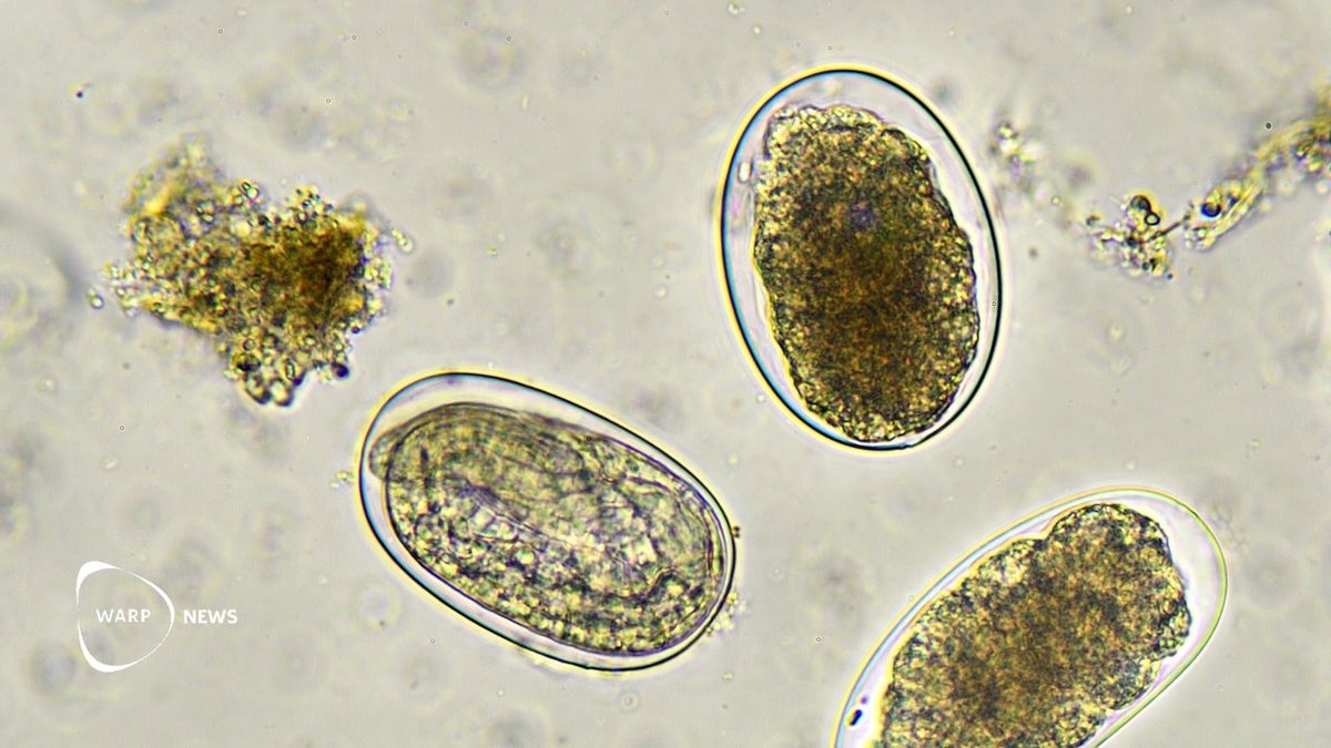 🪱 Hookworm vaccine reduces infection in trial – could help millions with anemia