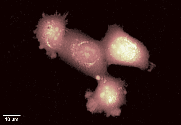 Enhancing fluorescence microscopy for Live-Cell imaging