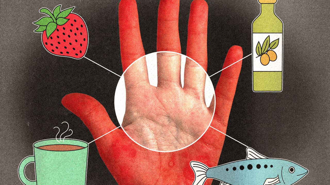 What to Eat (and Avoid) for Psoriasis Relief, According to Experts