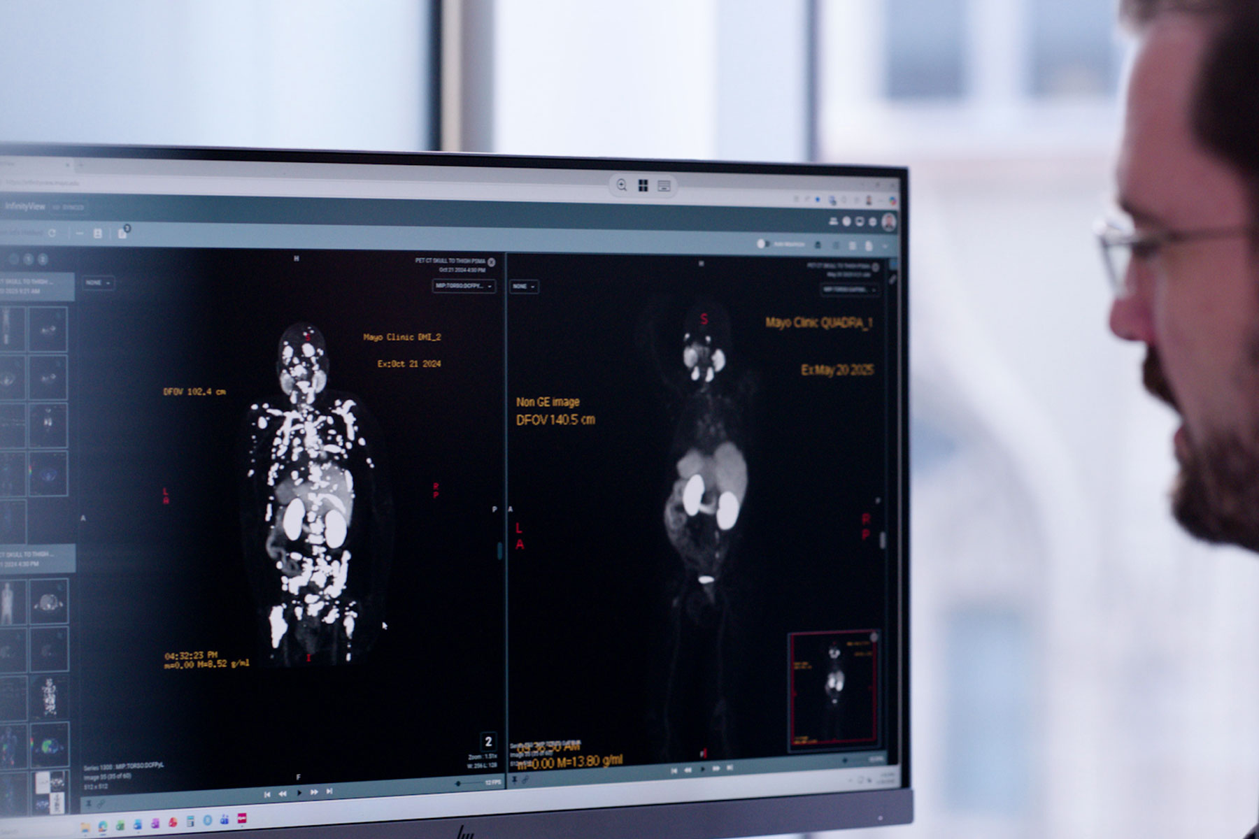 Why today’s prostate cancer patients have more options than ever