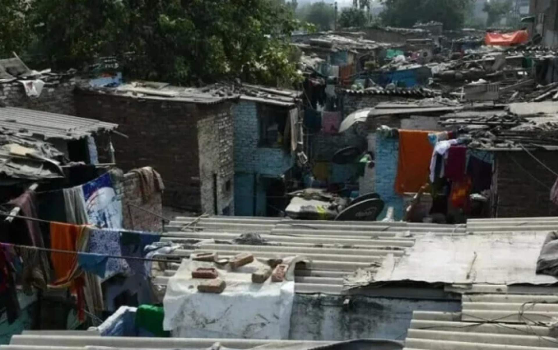 PDP urges Sindh action on monkeypox cases – Pakistan Today