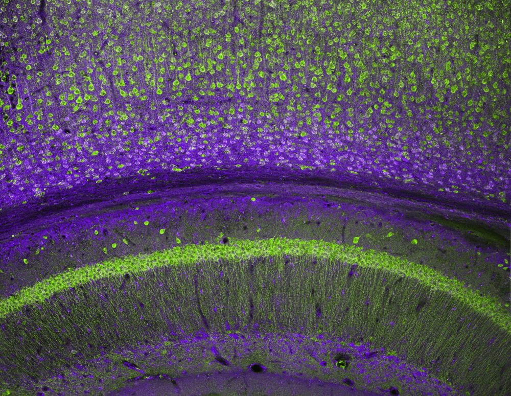 Scientists can now ‘edit’ brain circuits to enhance memory