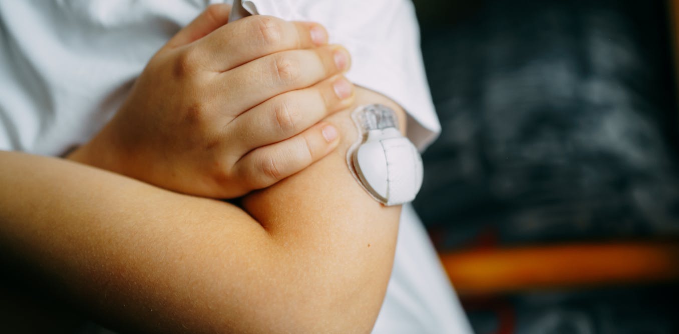 Umbilical cord blood may hold clues for a child’s risk of developing Type 1 diabetes