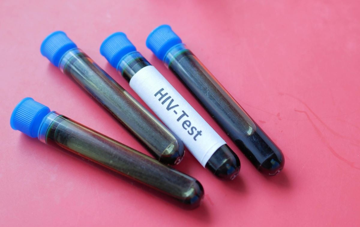 Dr Zafar Mirza warns over rising HIV cases – Pakistan Today