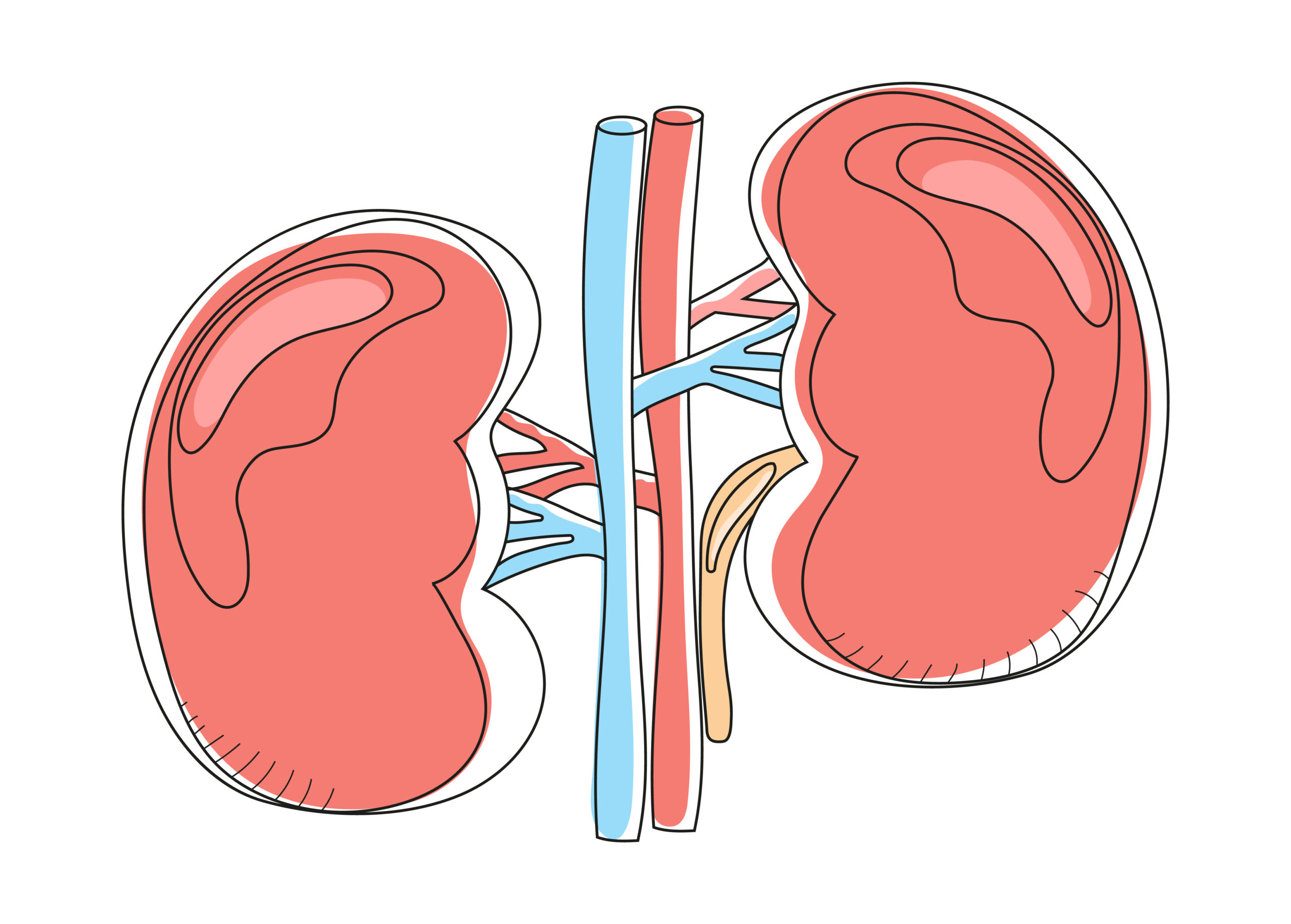 Metastatic Papillary Renal Cancer Final Results With Savolitinib and Durvalumab