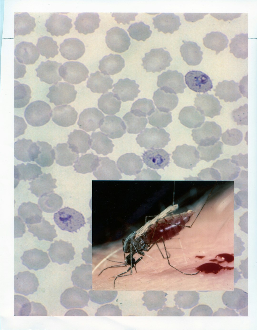 Brazil makes progress in controlling dengue and malaria