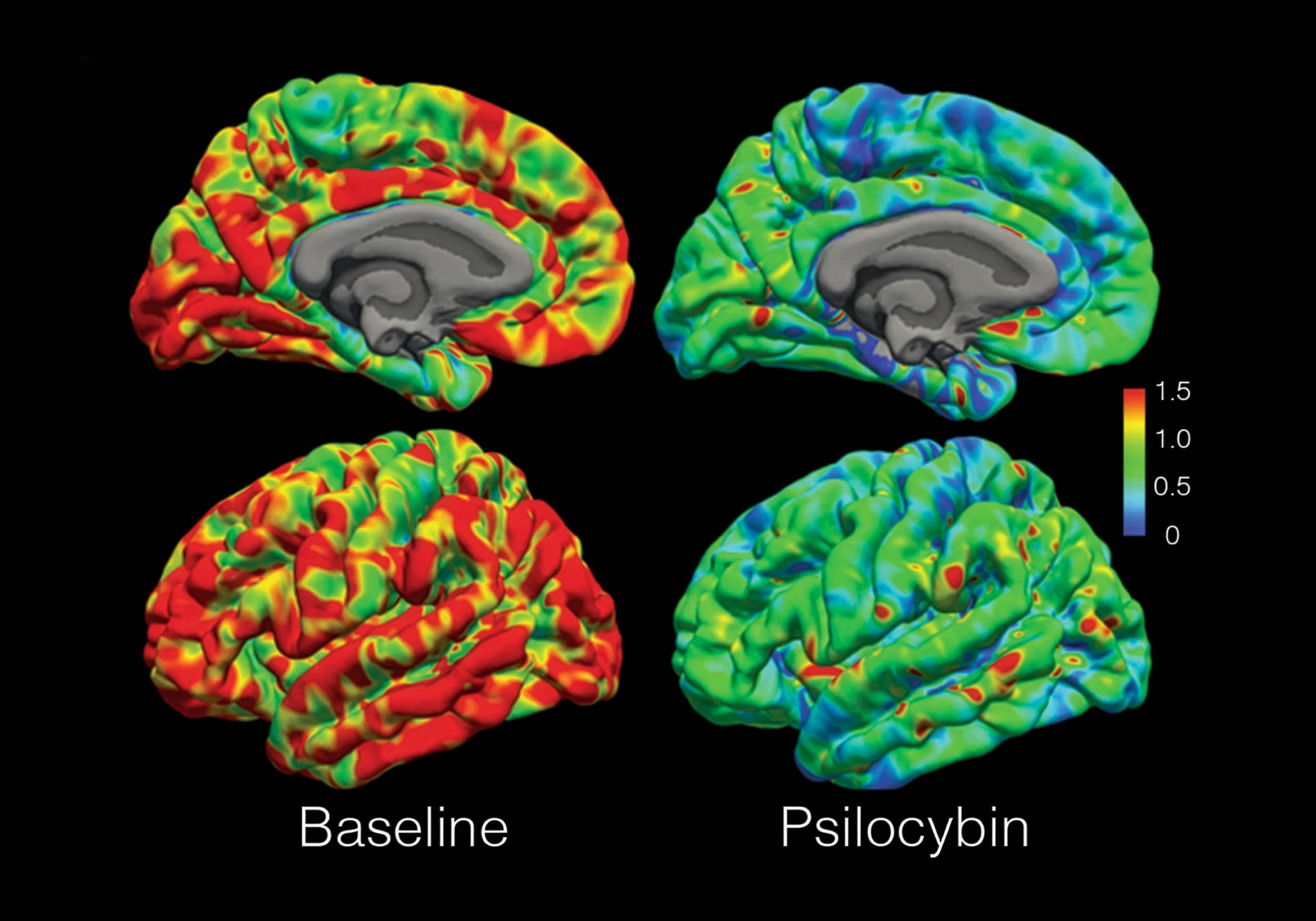 Different psychedelics create very similar brain wave patterns